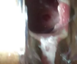 Mira dentro de su coño espéculo comedero putas cerdas
