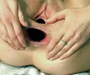 Webcam chica enorme anal gape  mujeres muy putas