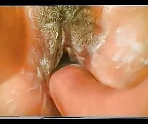 Anal  fisting