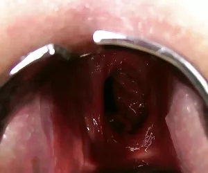 Kinkyniky doble anal fisting prolapso de la xo espéculo gape videosporn